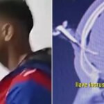 Gempar, Kunci Mobil Tersangkut di Kepala Pesepak Bola Argentina usai Terjadi Keributan