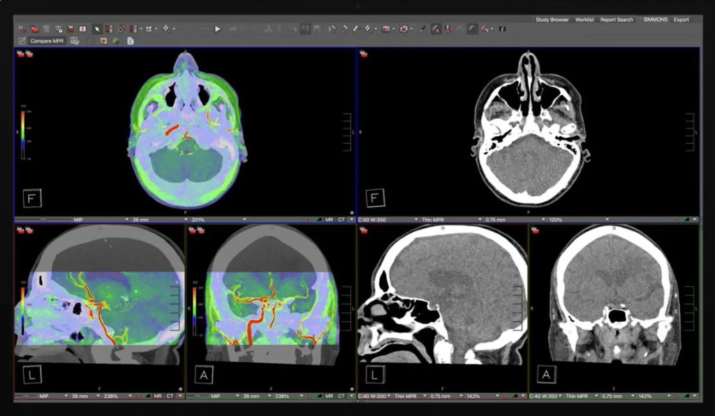 Studio Display XDR Kini Dukung DICOM untuk Radiologi Profesional
