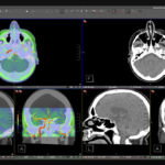 Studio Display XDR Kini Dukung DICOM untuk Radiologi Profesional