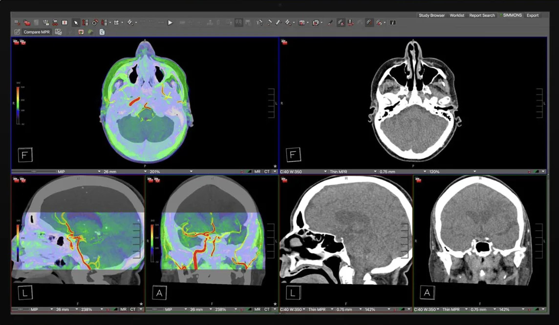 Studio Display XDR Kini Dukung DICOM untuk Radiologi Profesional