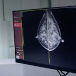 AI Bakal Jadi Kunci Musnahkan Kanker di Generasi Ini?
