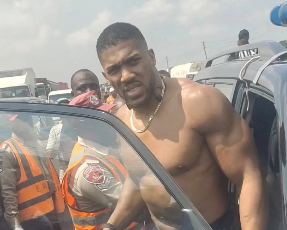 Kondisi Anthony Joshua Terkini usai Lolos dari Kecelakaan Maut
